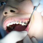 Kako smanjiti otok zuba